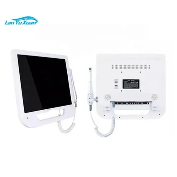Hot Selling DEquipment oral digital viewer with ntraoral